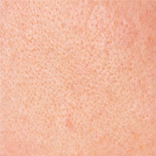 A close-up of skin pores. 